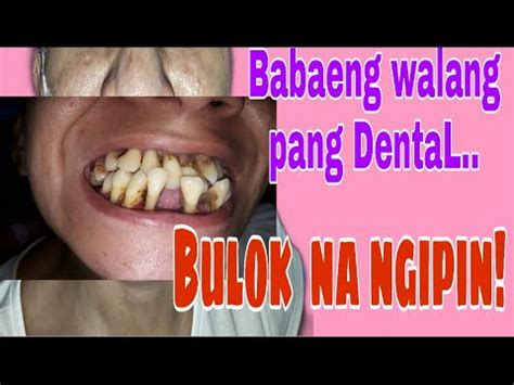 bulok na ngipin in english translation